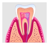 Fort Worth Root Canal Dentist Dr Sheri Audu