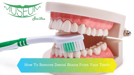 remove teeth stains